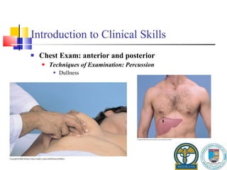 Introduction to Clinical Skills Chest Exam: anterior and posterior Techniques of Examination: Percussion Dullness 