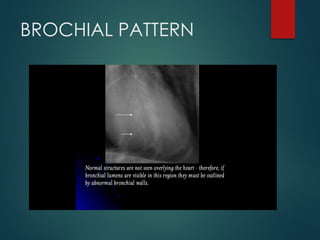 THORAX RADIOGRAPHIC INTERPRETATION CANINE | PPTX