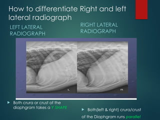 THORAX RADIOGRAPHIC TECHNIQUES INFORTHORAX XRAYMATION | PPTX