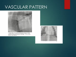 THORAX RADIOGRAPHIC TECHNIQUES INFORTHORAX XRAYMATION | PPTX