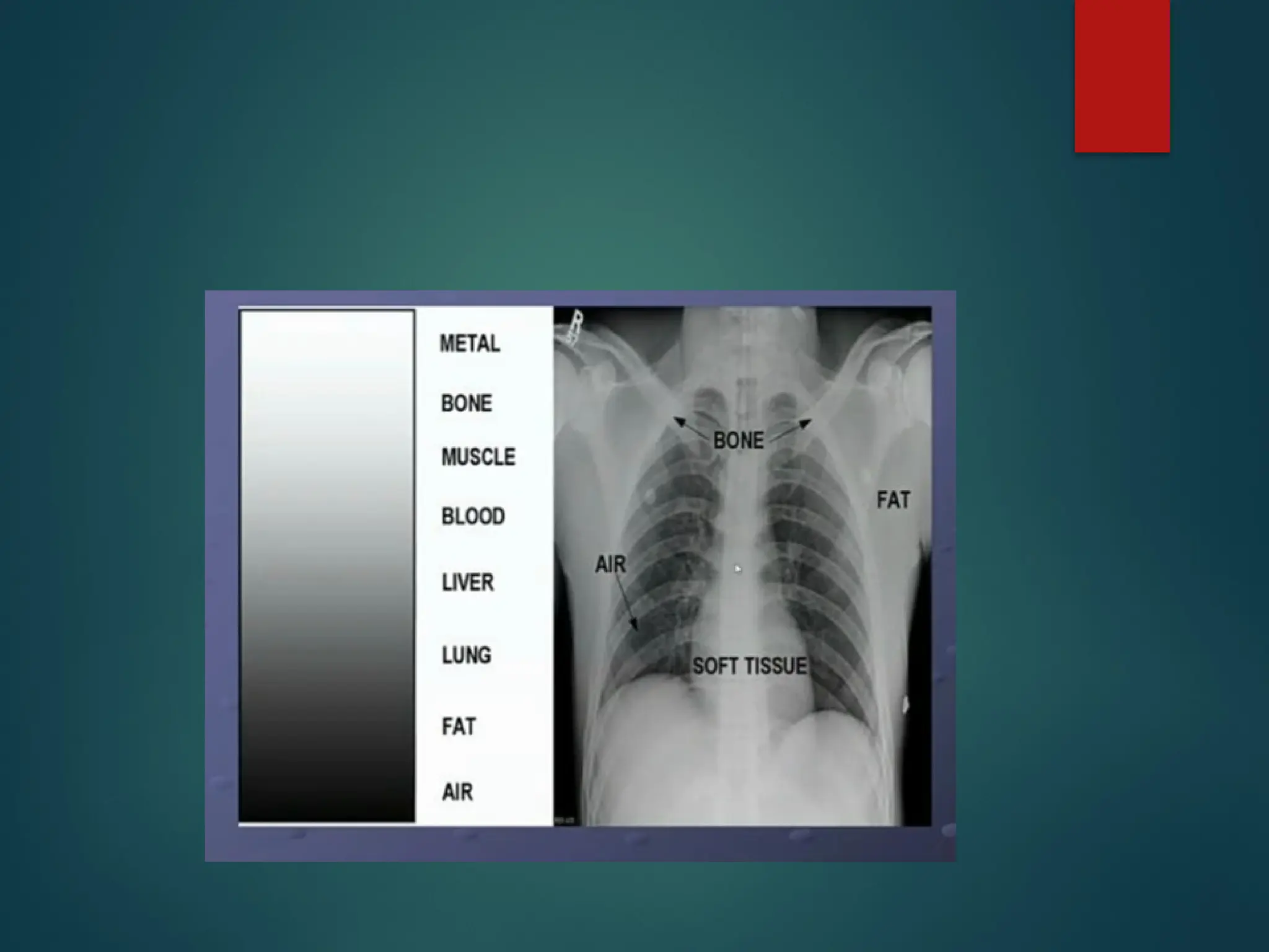 THORACIC RADIOGRAPH interpretation canine | PPTX