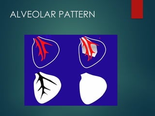 THORACIC RADIOGRAPH interpretation canine | PPTX