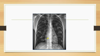 Thorax Rads Comprehensive Radiographic Anatomy of the Thorax with Cardiac ...