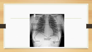 Human Thoracci Radiograph Comprehensive Radiographic Anatomy of the Thorax with Cardiac ...