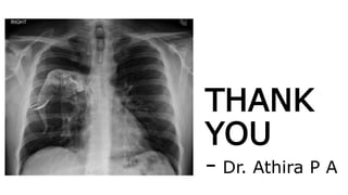 THANK
YOU
- Dr. Athira P A
 
