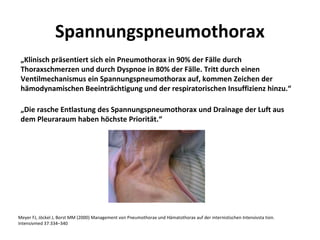 Spannungspneumothorax
 „Klinisch präsentiert sich ein Pneumothorax in 90% der Fälle durch
 Thoraxschmerzen und durch Dyspnoe in 80% der Fälle. Tritt durch einen
 Ventilmechanismus ein Spannungspneumothorax auf, kommen Zeichen der
 hämodynamischen Beeinträchtigung und der respiratorischen Insuffizienz hinzu.“

 „Die rasche Entlastung des Spannungspneumothorax und Drainage der Luft aus
 dem Pleuraraum haben höchste Priorität.“




Meyer FJ, Jöckel J, Borst MM (2000) Management von Pneumothorax und Hämatothorax auf der internistischen Intensivsta tion.
Intensivmed 37:334–340
 