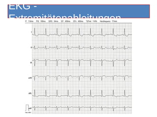 EKG -
Extremitätenableitungen




    Kardinal Schwarzenberg´sches Krankenhaus, Innere Medizin, Freitag 29. Juni 2012
 