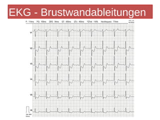 EKG - Brustwandableitungen
 