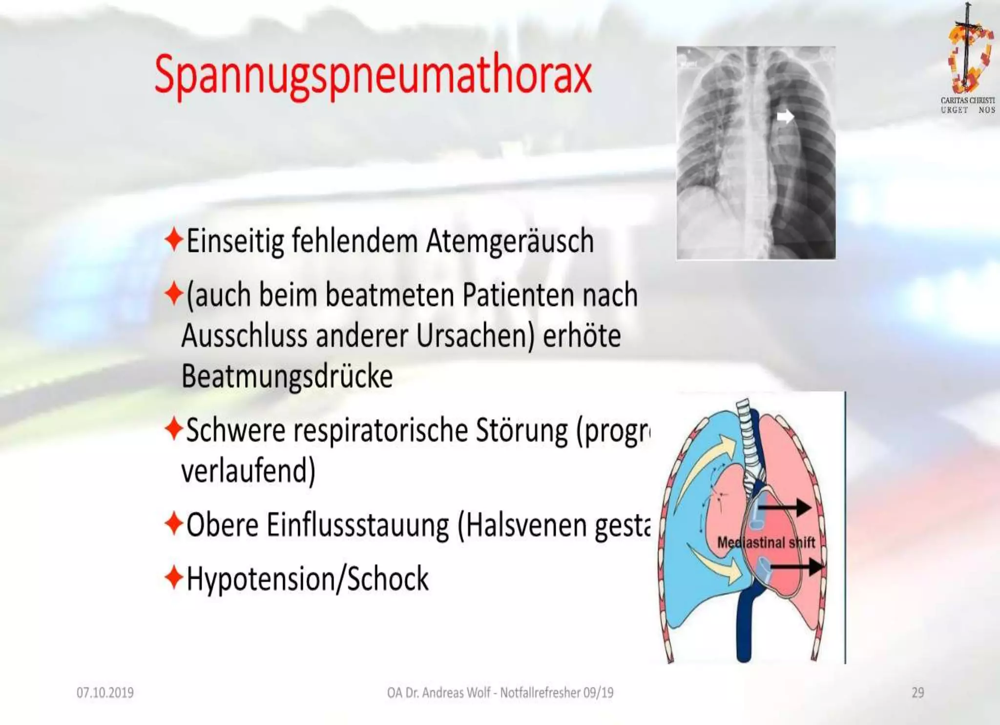 Management Beim Thoraxtrauma Und Bei Intrathorakalen Verletzungen WEXNPF management-beim-thoraxtrauma-und-bei-intrathorakalen-verletzungen-wexnpf