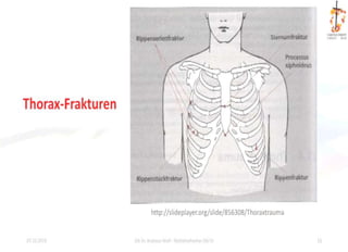 Das Kindliche Thoraxtrauma S2K Leitlinie Polytraumaversorgung Im das-kindliche-thoraxtrauma-s2k-leitlinie-polytraumaversorgung-im