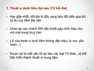 1. Thoát vị dưới liềm đại não (TV hồi đai)
- Hay gặp nhất, hồi đai bị đẩy sang bên đối diện qua bờ
tự do của liềm đại não
- Chèn ép các nhánh ĐM não trước gây nhồi máu nhu
mô mặt trong thuỳ trán
- LS của thoát vị dưới liềm không đặc hiệu( lơ mơ, yếu
chân...)
- Được coi là một yếu tố dự báo các loại TV khác, có thể
tiến triển thành thoát vị trung tâm.
 