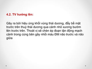 4.2. TV hướng lên:
Gây ra bởi hiệu ứng khối vùng thái dương, đẩy bề mặt
trước trên thuỳ thái dương qua cánh nhỏ xương bướm
lên trước trên. Thoát vị sẽ chèn ép đoạn tận động mạch
cảnh trong cùng bên gây nhồi máu ĐM não trước và não
giữa
 