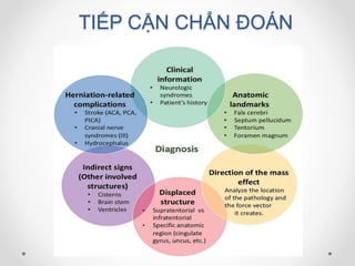 TIẾP CẬN CHẨN ĐOÁN
 