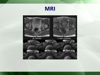 MRI
 