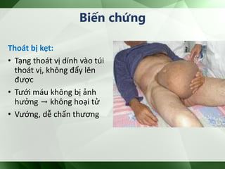 Thoát bị kẹt:
• Tạng thoát vị dính vào túi
thoát vị, không đẩy lên
được
• Tưới máu không bị ảnh
hưởng → không hoại tử
• Vướng, dễ chấn thương
Biến chứng
 