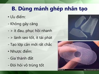 B. Dùng mảnh ghép nhân tạo
• Ưu điểm:
- Không gây căng
- > ít đau, phục hồi nhanh
- > lành sẹo tốt, ít tái phát
- Tạo lớp cân mới rất chắc
• Nhược điểm:
- Giáthành đắt
- Đòi hỏi vô trùng tốt
 