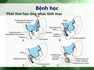 Bệnh học
Phôi thai học ống phúc tinh mạc
 