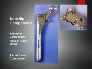 Total Hip
Components
1.Femoral
Components
(Head+ Neck+
Stem)
2.Acetabular
Components
 