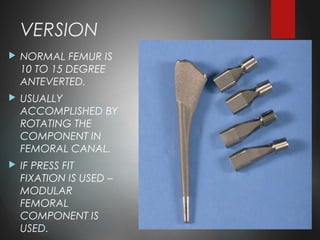 VERSION
 NORMAL FEMUR IS
10 TO 15 DEGREE
ANTEVERTED.
 USUALLY
ACCOMPLISHED BY
ROTATING THE
COMPONENT IN
FEMORAL CANAL.
 IF PRESS FIT
FIXATION IS USED –
MODULAR
FEMORAL
COMPONENT IS
USED.
 