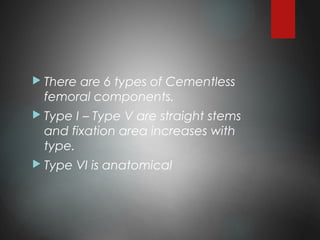  There are 6 types of Cementless
femoral components.
 Type I – Type V are straight stems
and fixation area increases with
type.
 Type VI is anatomical
 