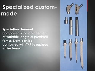 Specialized custom-
made
Specialized femoral
components for replacement
of variable length of proximal
femur. Stem can be
combined with TKR to replace
entire femur
 