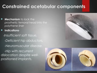 Constrained acetabular components
 Mechanism to lock the
prosthetic femoral head into the
polythene liner
 Indications-
-Insufficient soft tissue,
-Deficient hip abductors,
-Neuromuscular disease,
-Hip with recurrent
dislocation despite well-
positioned implants.
 
