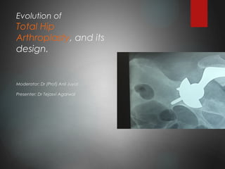 Evolution of
Total Hip
Arthroplasty, and its
design.
Moderator: Dr (Prof) Anil Juyal
Presenter: Dr Tejasvi Agarwal
 
