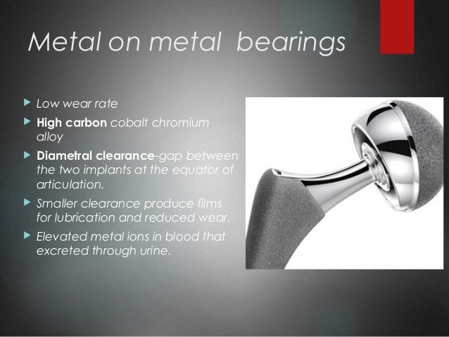 Evolution Of Total Hip Replacement