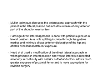 Direct Lateral Harding Approach THR | PPTX