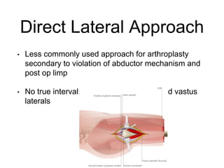 Direct Lateral Harding Approach THR | PPTX
