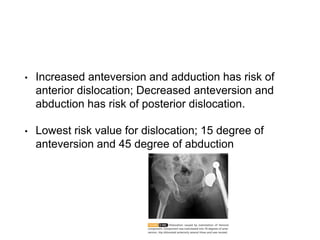 Abuction Risk THR | PPTX