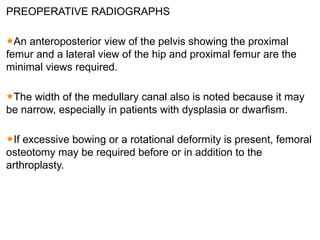 PREOPERATIVE RADIOGRAPHS
An anteroposterior view of the pelvis showing the proximal
femur and a lateral view of the hip and proximal femur are the
minimal views required.
The width of the medullary canal also is noted because it may
be narrow, especially in patients with dysplasia or dwarfism.
If excessive bowing or a rotational deformity is present, femoral
osteotomy may be required before or in addition to the
arthroplasty.
 