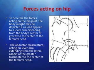 Forces acting on hip
• To describe the forces
  acting on the hip joint, the
  body weight may be
  depicted as a load applied
  to a lever arm extending
  from the body’s center of
  gravity to the center of the
  femoral head.
• The abductor musculature,
  acting on lever arm
  extending from the lateral
  aspect of the greater
  trochanter to the center of
  the femoral head.
 