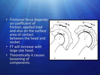 • Frictional force depends
  on coefficient of
  friction, applied load
  and also on the surface
  area of contact
  between the head and
  socket.
• FT will increase with
  large size head.
• Theoretically it causes
  loosening of
  components.
 