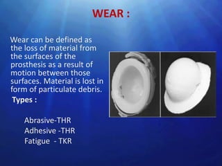 WEAR :

Wear can be defined as
the loss of material from
the surfaces of the
prosthesis as a result of
motion between those
surfaces. Material is lost in
form of particulate debris.
 Types :

    Abrasive-THR
    Adhesive -THR
    Fatigue - TKR
 
