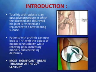 INTRODUCTION :
• Total hip arthroplasty is an
  operative procedure in which
  the diseased and destroyed
  hip joint is resected and
  replaced with a new bearing
  surface.

• Patients with arthritis can now
  look to THA with the object of
  maintaining stability, while
  relieving pain, increasing
  mobility and correcting
  deformity.

• MOST SIGNIFICANT BREAK
  THROUGH OF THE 20Th
  CENTURY
 