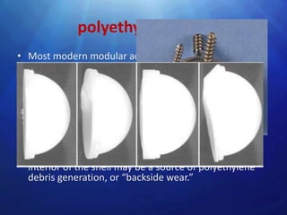 polyethylene liner
• Most modern modular acetabular components are
  supplied with a variety of polyethylene liner choices
• The polyethylene liner must be fastened securely to
  the metal shell.
• Current mechanisms include plastic flanges and metal
  wire rings that lock behind elevations or ridges in the
  metal shell, and peripherally placed screws
• in vivo dissociation of polyethylene liners from their
  metal backings has been reported micromotion
  between the nonarticulating side of the liner and the
  interior of the shell may be a source of polyethylene
  debris generation, or “backside wear.”
 