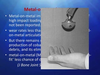 Metal-on-Metal Bearings
• Metal-on-metal implants seem to be tolerant of
  high impact loading, and mechanical failure has
  not been reported.
• wear rates less than 10 mm/y for modern metal-
  on-metal articulations
• But there remains major concern regarding the
  production of cobalt and chromium metallic
  debris, and its elimination from the body.
• metal-on-metal (MOM) bearings have a ‘suction-
  fit’ less chance of dislocation
         (J Bone Joint Surg [Br] 2003;85-B:650-4)
 
