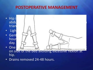 POSTOPERATIVE MANAGEMENT

• Hip is positioned in approximately 15 degree
  abduction and neutral rotation, with the help of a
  triangular pillow splint.
• Light skin traction may be applied for 24 hours. .
• Gentle isometric exercise for few minutes each
  hour when they are awake from first operative
  day.
• One the second postoperative day patient may sit
  on side of the bed avoiding excessive flexion at
  hip.
• Drains removed 24-48 hours.
 