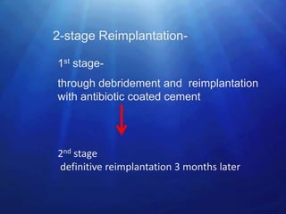 2-stage Reimplantation-

1st stage-
through debridement and reimplantation
with antibiotic coated cement




2nd stage
definitive reimplantation 3 months later
 