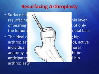 Resurfacing Arthroplasty
• Surface hip replacement consists of
  resurfacing the acetabulum with a thin layer
  of bearing surface, and replacement of only
  the femoral head (not neck) with a metal ball.
• The ideal candidate for a resurfacing hip
  arthroplasty is a young (<60 years old), active
  individual, with normal proximal femoral
  anatomy and bone density who might be
  anticipated to outlive a conventional hip
  arthroplasty.
 