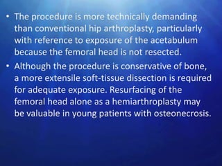 • The procedure is more technically demanding
  than conventional hip arthroplasty, particularly
  with reference to exposure of the acetabulum
  because the femoral head is not resected.
• Although the procedure is conservative of bone,
  a more extensile soft-tissue dissection is required
  for adequate exposure. Resurfacing of the
  femoral head alone as a hemiarthroplasty may
  be valuable in young patients with osteonecrosis.
 