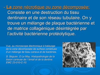 -- LaLa zone nécrotique ou zone décomposée:zone nécrotique ou zone décomposée:
Consiste en une destruction du tissuConsiste en une destruction du tissu
dentinaire et de son réseau tubulaire. On ydentinaire et de son réseau tubulaire. On y
trouve un mélange de plaque bactérienne ettrouve un mélange de plaque bactérienne et
de matrice collagénique désintégrée parde matrice collagénique désintégrée par
l’activité bactérienne protéolytique.l’activité bactérienne protéolytique.
Vue, au microscope électronique à balayageVue, au microscope électronique à balayage
de la zone décomposée de surface constituéede la zone décomposée de surface constituée
d’un mélange de tissu carieux et de bactéries.d’un mélange de tissu carieux et de bactéries.
S. Séguier, O Le May. Histopathologie de laS. Séguier, O Le May. Histopathologie de la
lésion carieuse de l ’émail et de la dentine.lésion carieuse de l ’émail et de la dentine.
EMC 23-010-C-10.EMC 23-010-C-10.
 