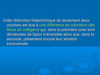 Cette distinction histochimique de seulement deuxCette distinction histochimique de seulement deux
couches est due àcouches est due à une différence de coloration desune différence de coloration des
fibres de collagènefibres de collagène qui, dans la première zone sontqui, dans la première zone sont
dénaturées de façon irréversible alors que, dans ladénaturées de façon irréversible alors que, dans la
seconde, présentent encore leur striationseconde, présentent encore leur striation
transversale.transversale.
 