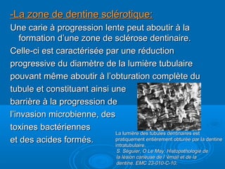 -La zone de dentine sclérotique:-La zone de dentine sclérotique:
Une carie à progression lente peut aboutir à laUne carie à progression lente peut aboutir à la
formation d’une zone de sclérose dentinaire.formation d’une zone de sclérose dentinaire.
Celle-ci est caractérisée par une réductionCelle-ci est caractérisée par une réduction
progressive du diamètre de la lumière tubulaireprogressive du diamètre de la lumière tubulaire
pouvant même aboutir à l’obturation complète dupouvant même aboutir à l’obturation complète du
tubule et constituant ainsi unetubule et constituant ainsi une
barrière à la progression debarrière à la progression de
l’invasion microbienne, desl’invasion microbienne, des
toxines bactériennestoxines bactériennes
et des acides formés.et des acides formés.
La lumière des tubules dentinaires estLa lumière des tubules dentinaires est
pratiquement entièrement obturée par la dentinepratiquement entièrement obturée par la dentine
intratubulaire.intratubulaire.
S. Séguier, O Le May. Histopathologie deS. Séguier, O Le May. Histopathologie de
la lésion carieuse de l ’émail et de lala lésion carieuse de l ’émail et de la
dentine. EMC 23-010-C-10.dentine. EMC 23-010-C-10.
 