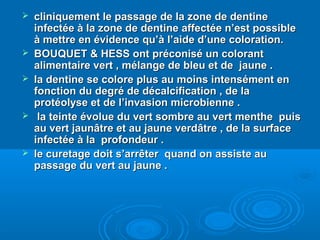  cliniquement le passage de la zone de dentinecliniquement le passage de la zone de dentine
infectée à la zone de dentine affectée n’est possibleinfectée à la zone de dentine affectée n’est possible
à mettre en évidence qu’à l’aide d’une coloration.à mettre en évidence qu’à l’aide d’une coloration.
 BOUQUET & HESS ont préconisé un colorantBOUQUET & HESS ont préconisé un colorant
alimentaire vert , mélange de bleu et de jaune .alimentaire vert , mélange de bleu et de jaune .
 la dentine se colore plus au moins intensément enla dentine se colore plus au moins intensément en
fonction du degré de décalcification , de lafonction du degré de décalcification , de la
protéolyse et de l’invasion microbienne .protéolyse et de l’invasion microbienne .
 la teinte évolue du vert sombre au vert menthe puisla teinte évolue du vert sombre au vert menthe puis
au vert jaunâtre et au jaune verdâtre , de la surfaceau vert jaunâtre et au jaune verdâtre , de la surface
infectée à la profondeur .infectée à la profondeur .
 le curetage doit s’arrêter quand on assiste aule curetage doit s’arrêter quand on assiste au
passage du vert au jaune .passage du vert au jaune .
 