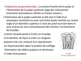 - Pulpotomie proprement dite : La section franche de la pulpe et
l’élimination de la pulpe camérale exige des instruments
tranchants (excavateurs affutés ou fraises neuves ).
L’élimination de la pulpe camérale se fait soit à l’aide d’un
excavateur tranchant ou avec une fraise boule montée sur contre
angle d’un diamètre supérieur à celui du canal tournant dans le
sens inverse du sens conventionnel afin d’éviter l’arrachement
de la pulpe.
-L'action sécante porte à la fois sur la pulpe
et la dentine, de façon à créer un moignon
pulpaire très net, entouré d'un épaulement
sur lequel prendra appui le produit de coiffage.
-Elimination des débris pulpaire et dentinaire
à l’aide d’excavateur J.C.HESS
Clinique endodontique
 