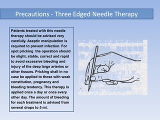 Precautions - Three Edged Needle Therapy
Patients treated with this needle
therapy should be advised very
carefully. Aseptic manipulation is
required to prevent infection. For
spot pricking the operation should
be slight, stable, correct and rapid
to avoid excessive bleeding and
injury of the deep large arteries or
other tissues. Pricking shall in no
case be applied to those with weak
constitution, pregnancy and
bleeding tendency. This therapy is
applied once a day or once every
other day. The amount of bleeding
for each treatment is advised from
several drops to 5 ml.
 
