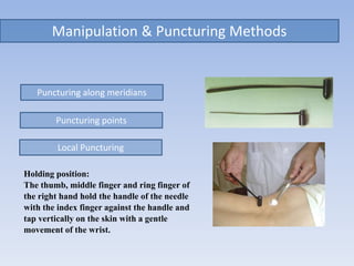 Manipulation & Puncturing Methods
Puncturing along meridians
Puncturing points
Holding position:
The thumb, middle finger and ring finger of
the right hand hold the handle of the needle
with the index finger against the handle and
tap vertically on the skin with a gentle
movement of the wrist.
Local Puncturing
 
