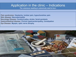 Application in the clinic – Indications
The cutaneous needling is extensively used to treat:
Pain syndromes: Headache, lumbar pain, hypochondriac pain
Skin disease: Neurodermatitis
Neurology Disease: Cerebral palsy, stroke, facial paralysis
Gastrointestinal disease: Chronic gastroenteropathy, constipation
Eye Disease: Myopia, optic nerve atrophy
 
